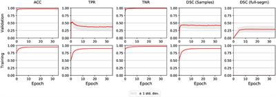 Evaluation of Enhanced Learning Techniques for Segmenting Ischaemic Stroke Lesions in Brain Magnetic Resonance Perfusion Images Using a Convolutional Neural Network Scheme